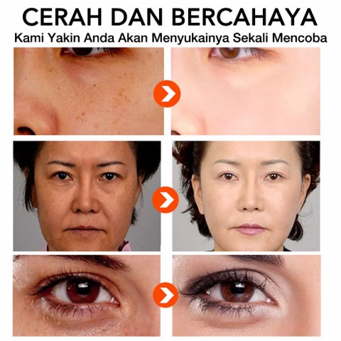 Vitamin Bahan Alami Serum Bergizi Kulit