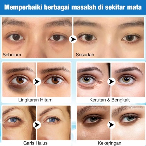 Serum Mata 5% Kafein