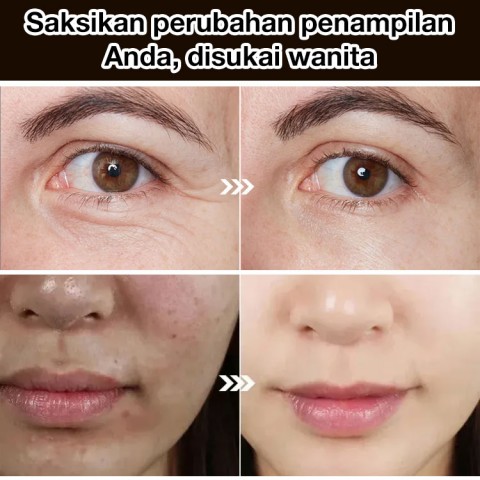 Serum pengencang anti kerut
