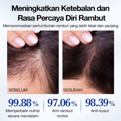 Serum Penumbuh Rambut Minoxidil 5%