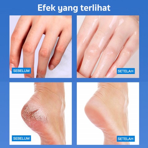 Stik Pelembab Vaseline Peach-Mengatasi persendian tangan dan kaki yang pecah-pecah/terkelupas/hitam