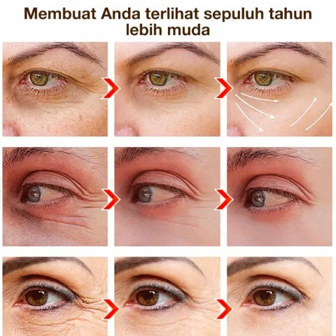 Krim Mata Begadang Anti Kerutan Kafein