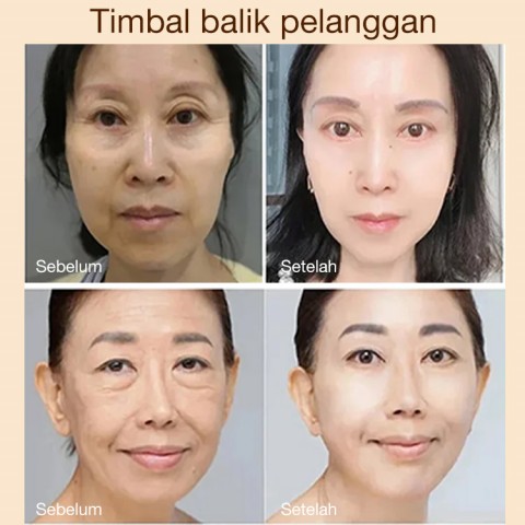 Krim Mata Begadang Anti Kerutan Kafein