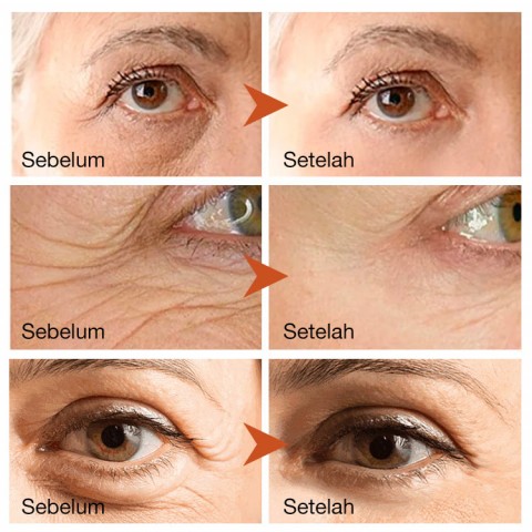 Serum Pengencang Mata Instan