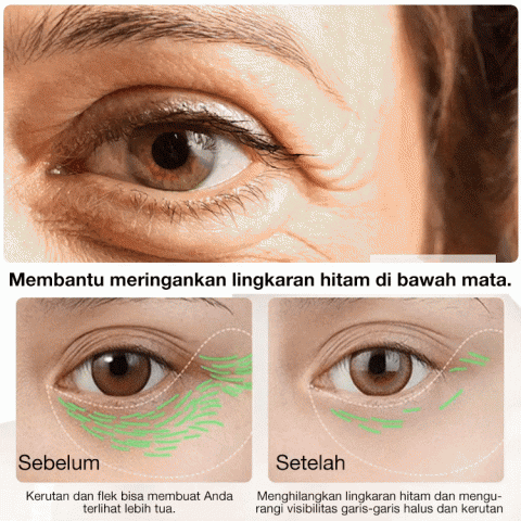 Serum Pengencang Mata Instan