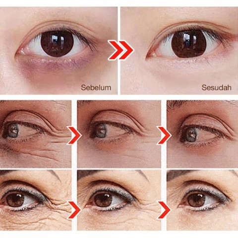 Minyak Serum Mata Lutein