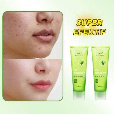 Aloe Vera Soothing Repair Pelembab Jerawat Gel