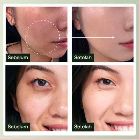 Gaya Panas Korea - Tiga-dalam-satu Concealer Sunscreen Brightening Air Cushion