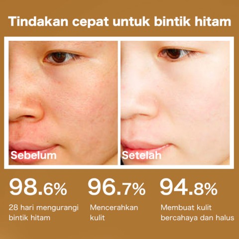 377 Vita C serum dan krim-Memutihkan dalam, menghilangkan melasma, bintik-bintik, bintik matahari, Bekas jerawat, bintik-bintik penuaan