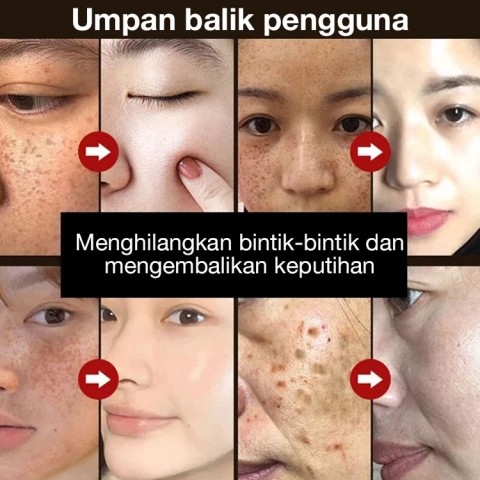 masker anti noda dan anti kerut