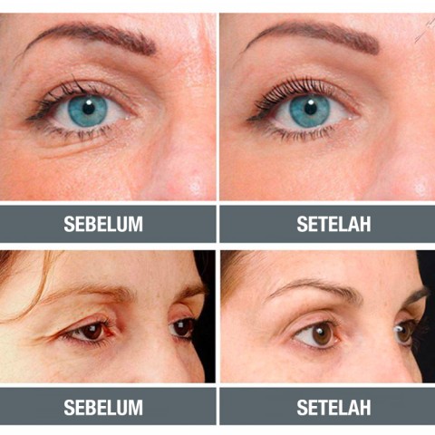 Serum Wajah Anti Penuaan Peningkat Kolagen Tingkat Lanjut