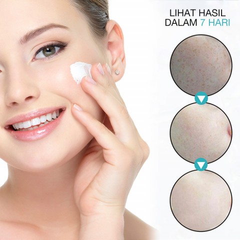 Krim Serum Anti Bintik Hitam