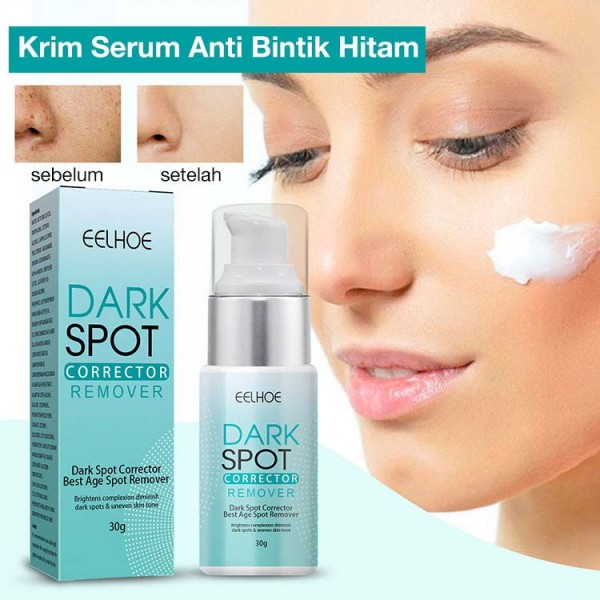 Krim Serum Anti Bintik Hitam