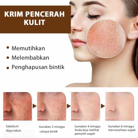 Advanced Niacinamide (Vitamin B3) Krim Pemutih dan Pencerah