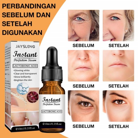 Promosi Hari Ibu 3PCS Rp298.000-Efek Penuh Serum Anti Kerut Menghilangkan Kerut Mengangkat Kulit Mengencangkan