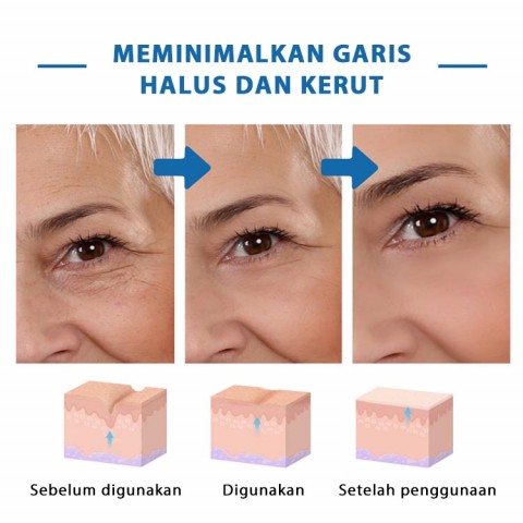 Serum Anti Keriput B5