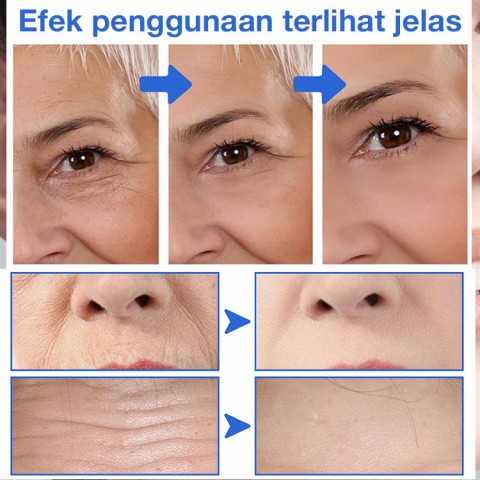 Serum anti penuaan toksin botulinum