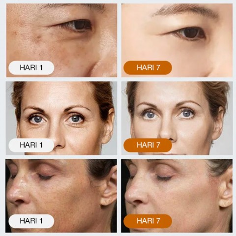 Serum Anti Kerutan Kolagen Kecantikan Korea
