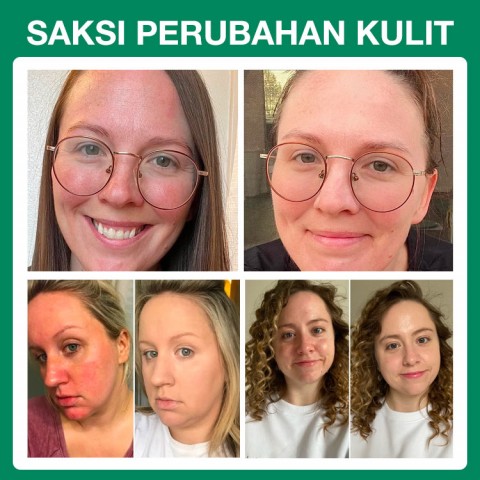 Krim Pengoreksi Warna