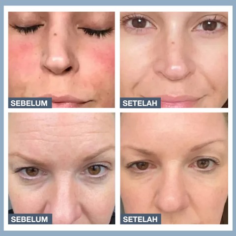 Masker Kolagen
