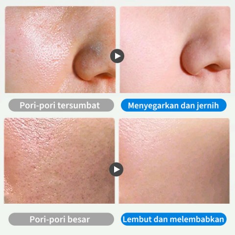 Masker lumpur pembersih-Mengecilkan pori-pori dan menghilangkan komedo