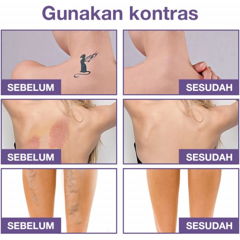 Penutup kulit tubuh concealer
