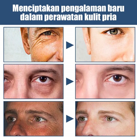 Pelembab Kerut Wajah untuk Pria