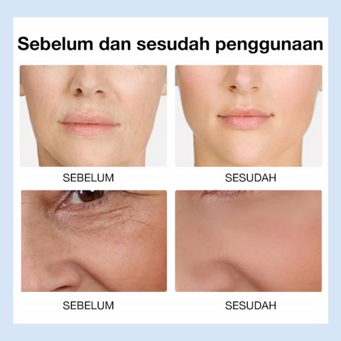 Krim Pengisi Kolagen