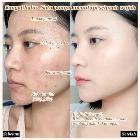 Krim Pemutih Vitamin C Lima Kali Lipat Niacinamide