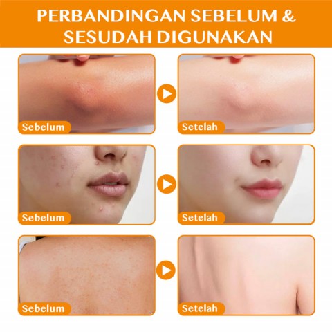 Tersedia untuk seluruh tubuh - gel pembersih eksfoliasi - eksfoliasi, menghilangkan komedo, membersihkan pori-pori