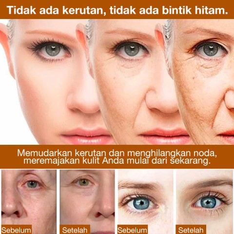 Pro-xylane Esensi Pengisi Kerut Peptida
