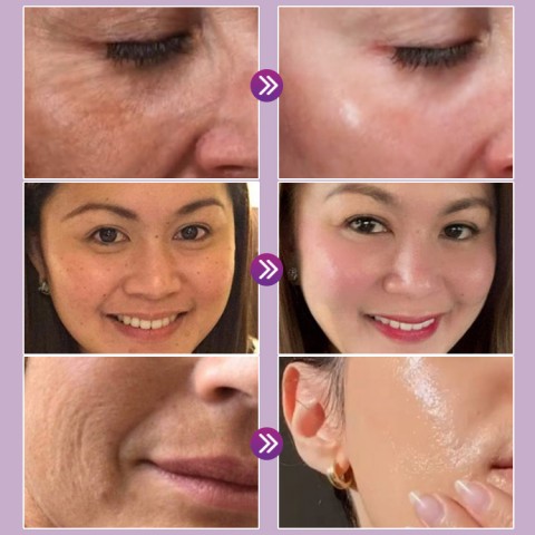 Serum Pengencang Retinol