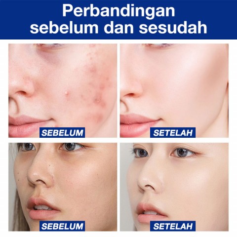 Salep Retinol