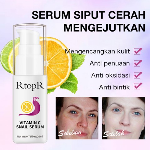 Kit Pemutih Vitamin C