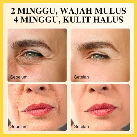 Minyak esensial anti kerut VC