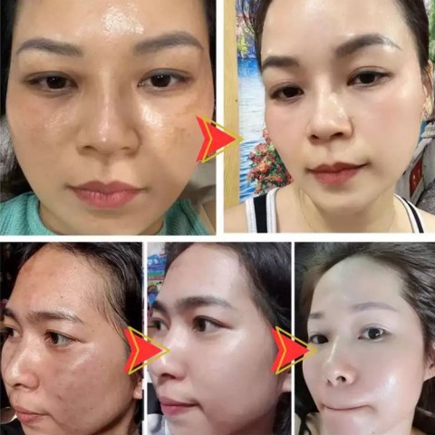 Krim pemutih dan anti bintik