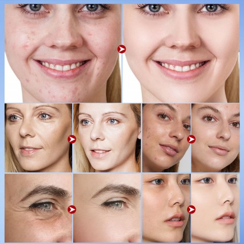 Serum anti penuaan