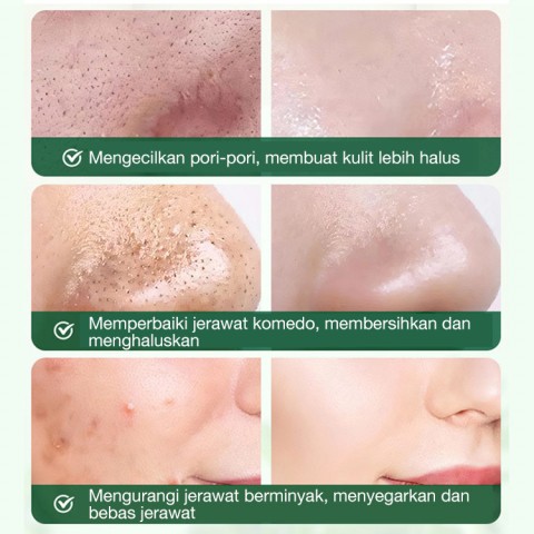 Tongkat masker lumpur