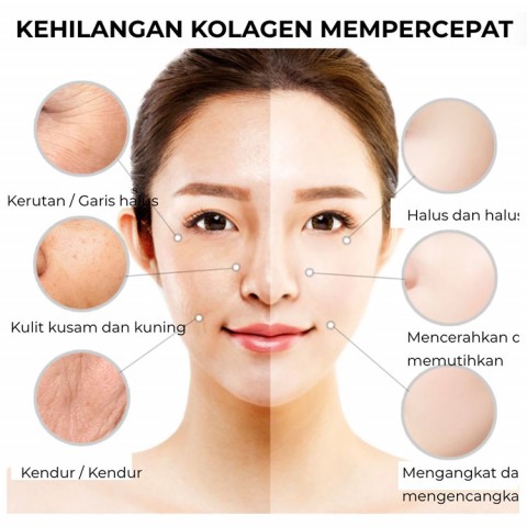 Krim anti penuaan dan krim pemutih VC