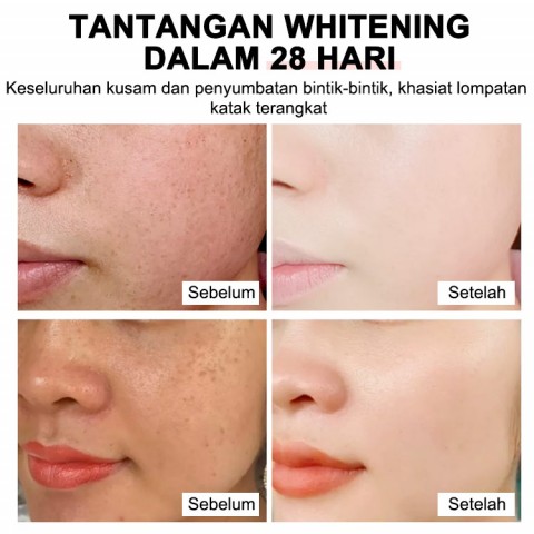 Arbutin glowing toner-Meningkatkan kusam dan mencerahkan warna kulit