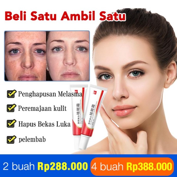Krim bintik niacinamide