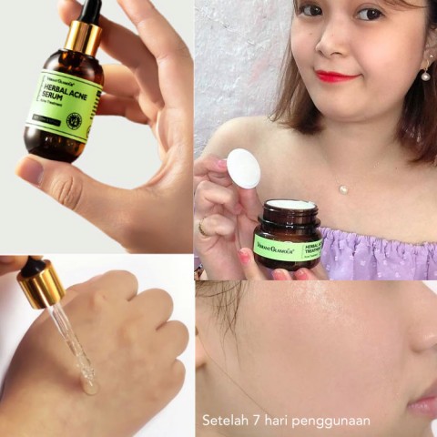 Krim dan Serum Perawatan Jerawat Herbal-Beli 1 Ambil 1