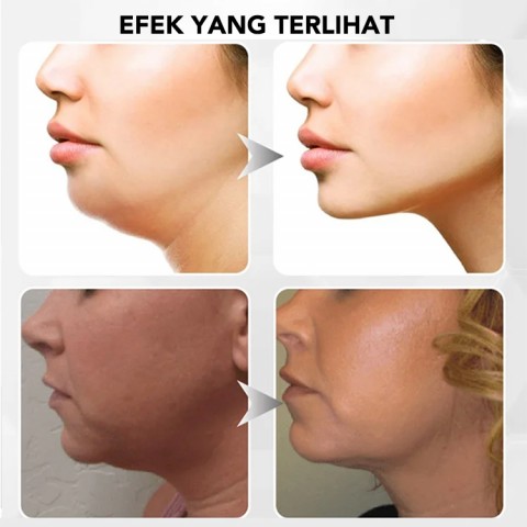 Mengangkat Firming V Masker Wajah