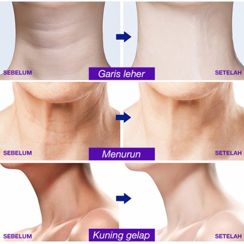 Krim perawatan leher