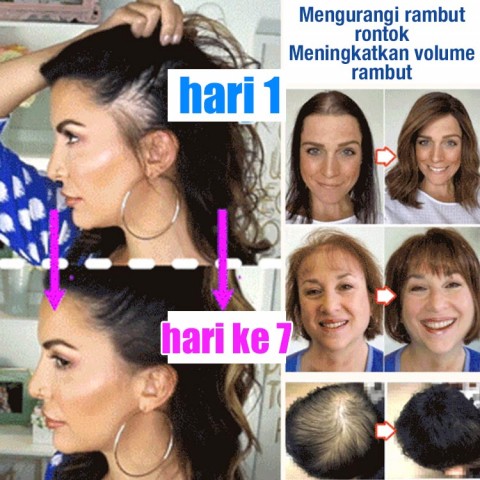 Serum anti rambut rontok