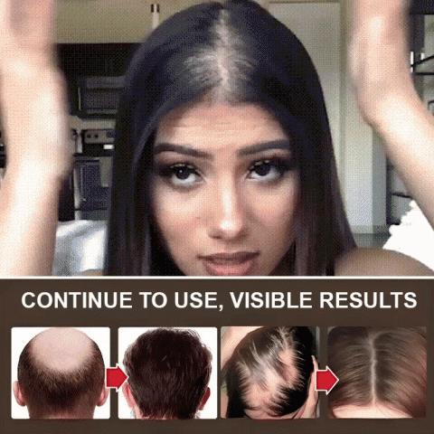 Minyak Esensial Pertumbuhan Rambut Rosemary Alami