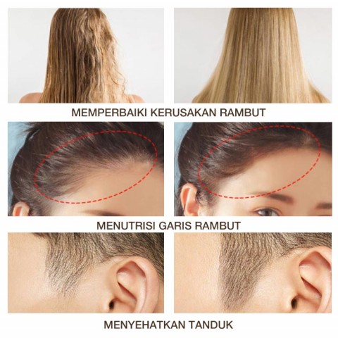 MINYAK MASKER RAMBUT BERGIZI & SET PERAWATAN KEMBALI KULIT