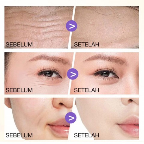 Patch anti kerut