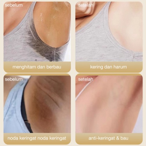 Tongkat Antiperspiran
