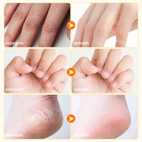 Minyak Esensial Tangan dan Kaki dari Tiga Tanaman